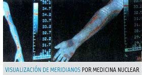 meridianos